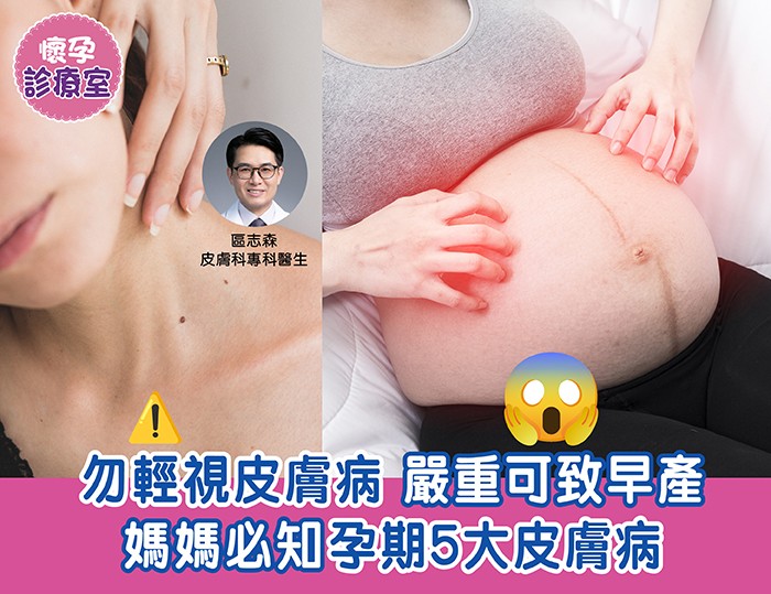 孕婦健康