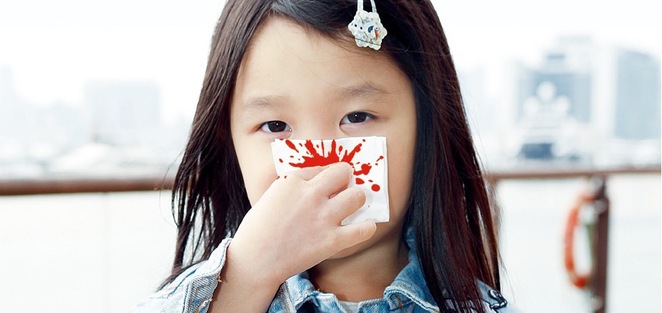 點解孩子經常流鼻血？