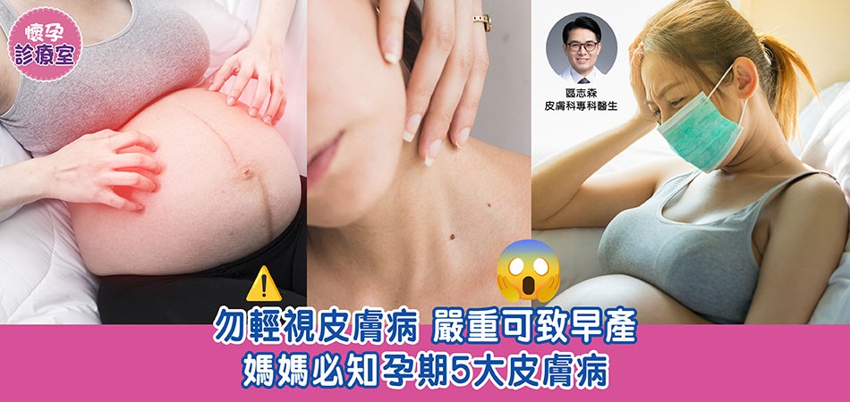 懷孕痛症｜勿輕視皮膚病 嚴重可致早產 媽媽必知孕期5大皮膚病