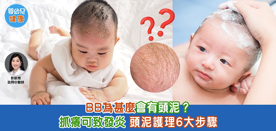 秋冬嬰幼兒健康｜BB為甚麼會有頭泥？ 抓癢可致發炎+頭泥護理6大步驟