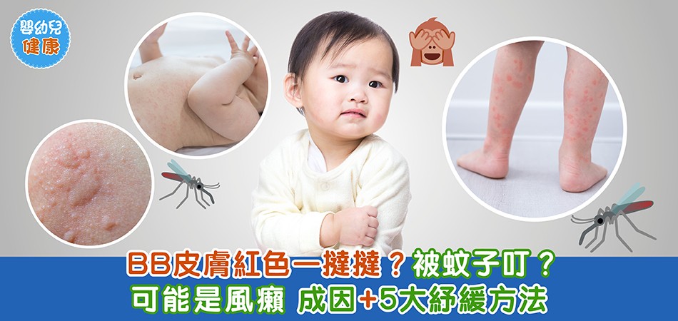 秋冬嬰幼兒健康｜BB皮膚上有一撻撻紅色腫塊？長風癩或被蚊子叮？ 風癩成因+5大紓綬方法