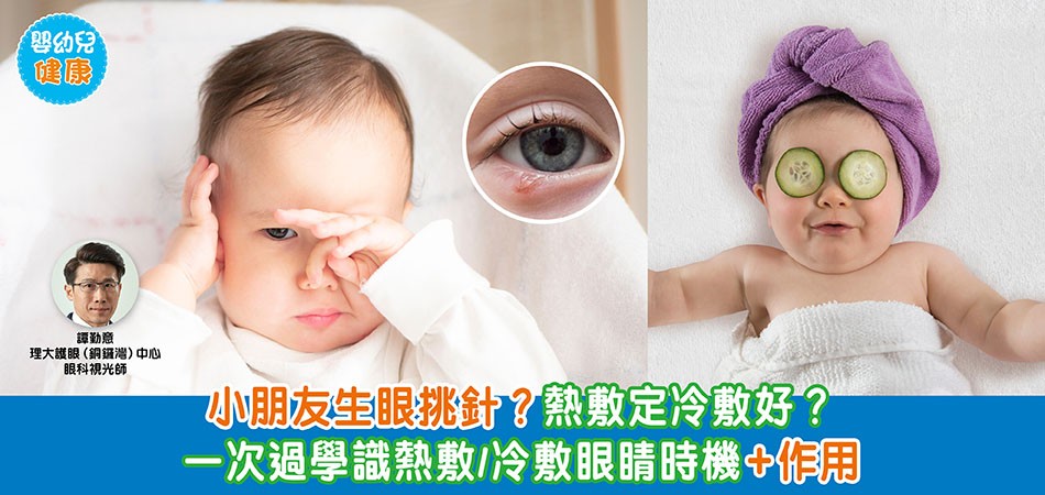 眼睛健康｜小朋友生眼挑針？熱敷定冷敷好？ 一次過學識熱敷/冷敷眼睛時機+作用