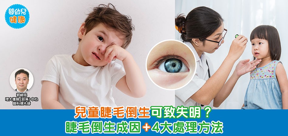 眼睛健康｜兒童睫毛倒生可致失明？ 睫毛倒生成因+4大處理方法