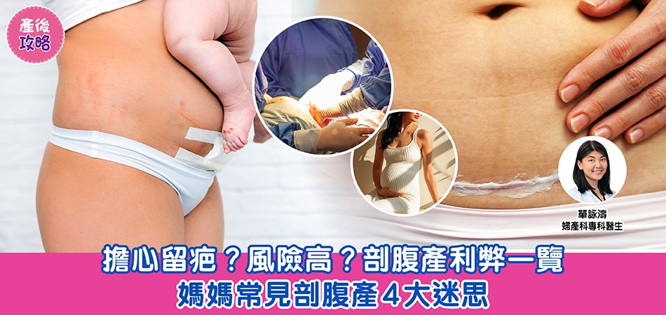 產後攻略|擔心留疤?風險高?剖腹產利弊一覽 媽媽常見剖腹產4大迷思 產後攻略|擔心留疤?風險高?剖腹產利弊一覽 媽媽常見剖腹產4大迷思