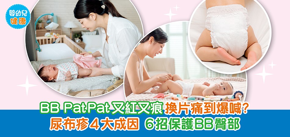 嬰幼兒健康|BB PatPat又紅又痕換片痛到爆喊?尿布疹4大成因 6招保護BB臀部 附BB護臀膏推介 嬰幼兒健康|BB PatPat又紅又痕換片痛到爆喊?尿布疹4大成因 6招保護BB臀部 附BB護臀膏推介