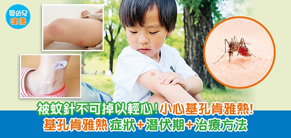 嬰幼兒健康｜被蚊針不可掉以輕心！小心基孔肯雅熱！基孔肯雅熱症狀+潛伏期+治療方法